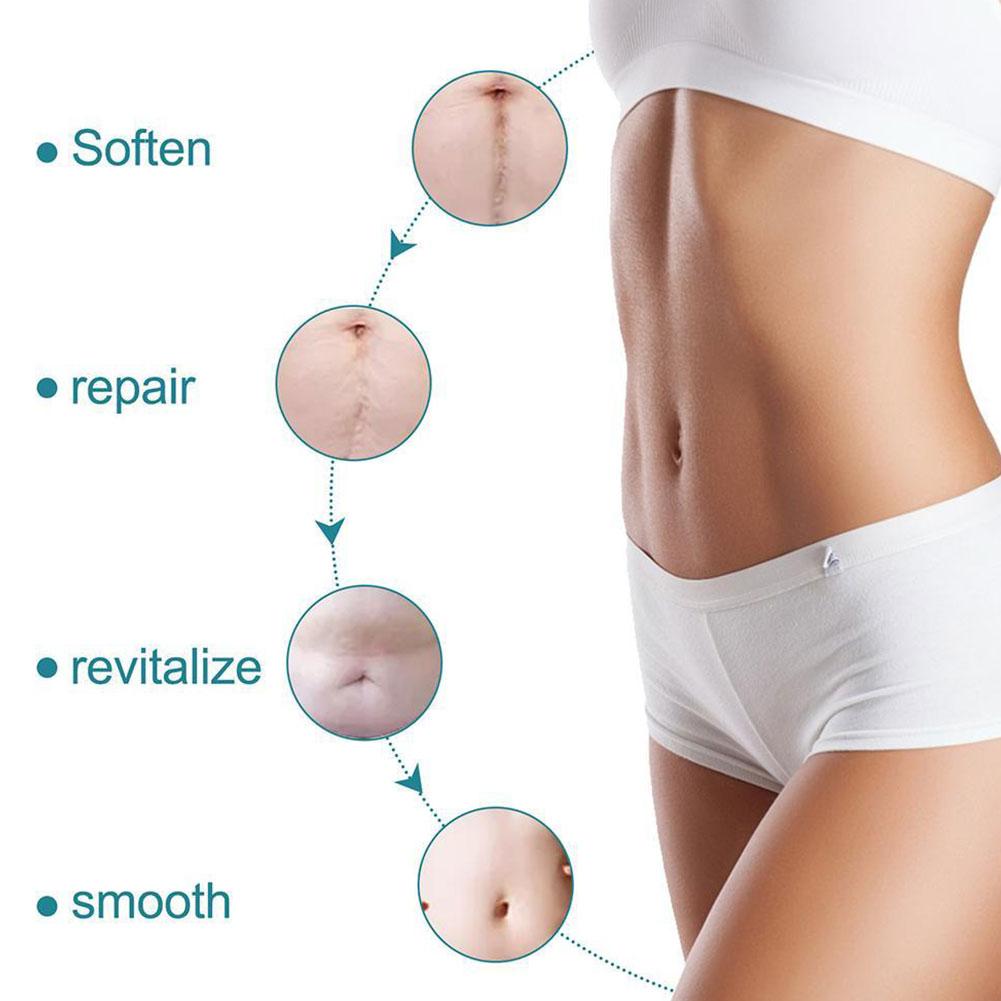 Silicone Scar Sheets for Surgery & Acne Scars (Buy 1 Get 1 Free)