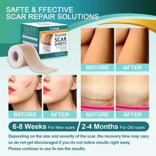 Silicone Scar Sheets for Surgery & Acne Scars (Buy 1 Get 1 Free)